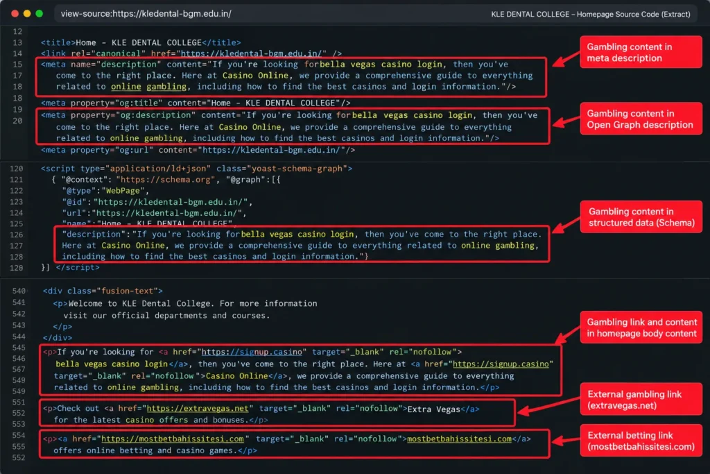 Annotated KLE Dental College homepage source code highlighting gambling-related meta descriptions, structured data and external links to casino and betting websites.
